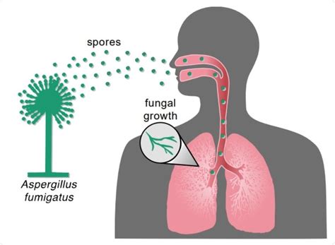 곰팡이 포자 흡입: 우리가 무시할 수 없는 미세한 위협